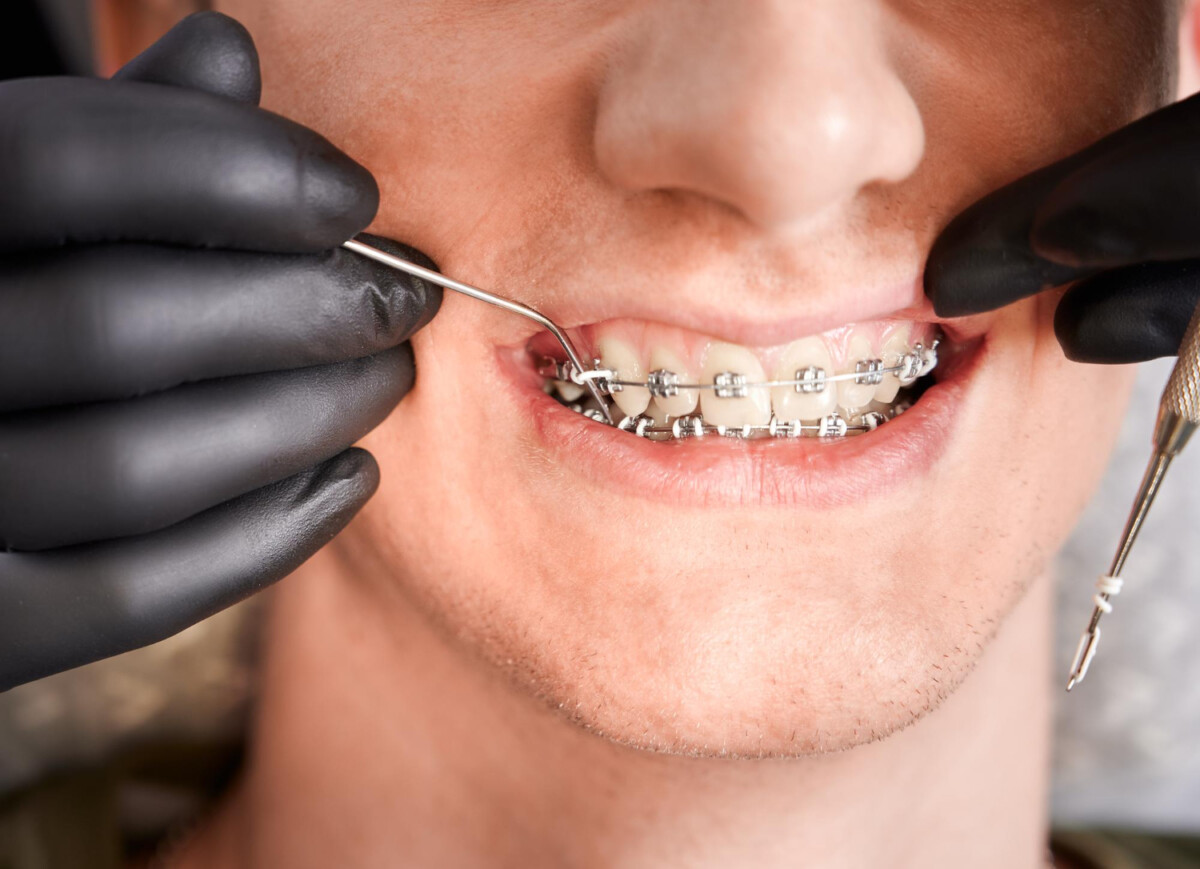 How Orthodontic Treatment Can Improve Your Oral Health