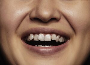 How Orthodontic Treatment Can Improve Your Oral Health